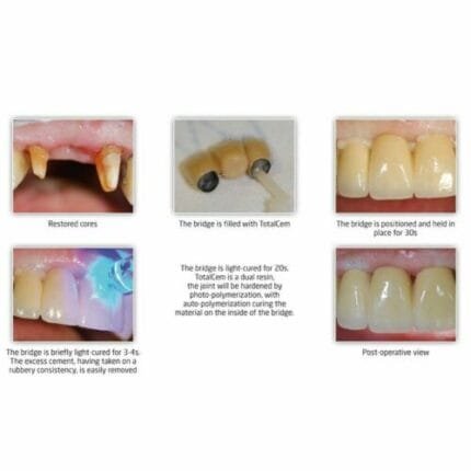 5x Dental 2% 1 in 80000 30ml (Free & Fast Shipping)